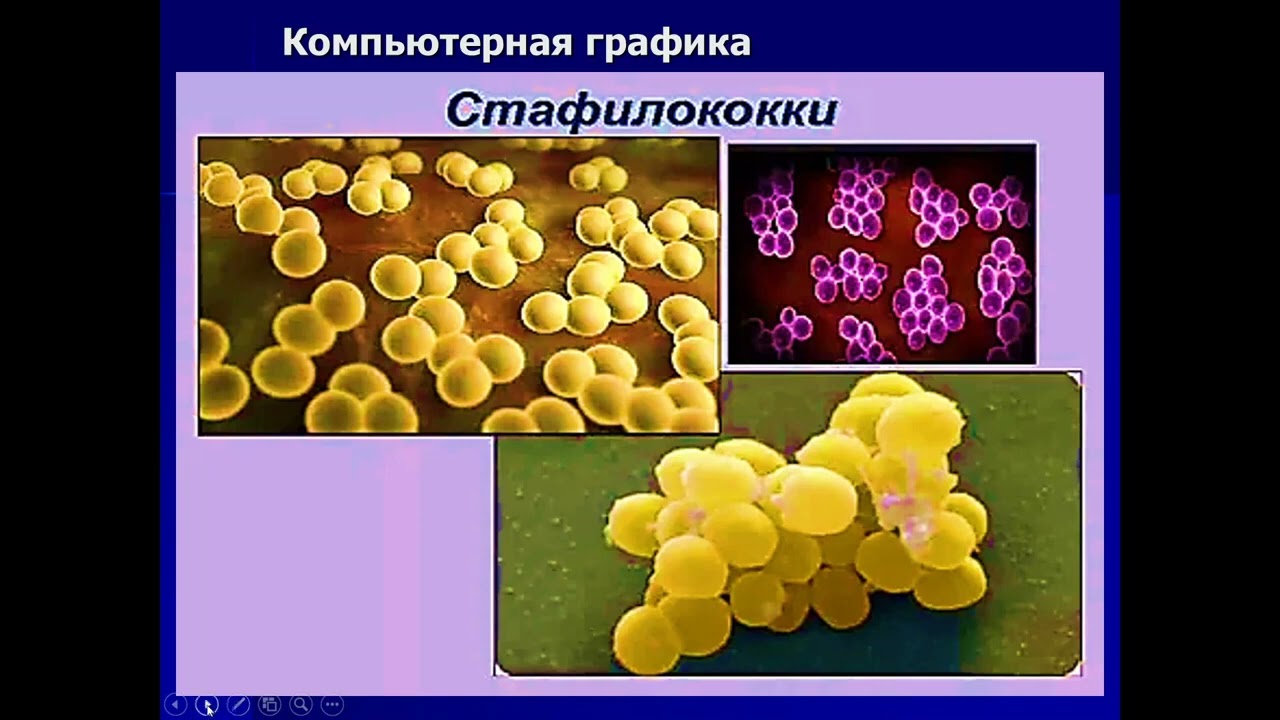 Костина Ю  А  Патогенные кокки   возбудители воспалительных заболеваний у человека