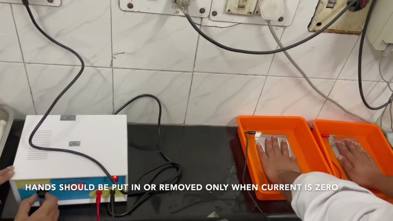 Iontophoresis for  hyperhidrosis (Increased sweating from palms and soles) Dr Bhawuk Dhir