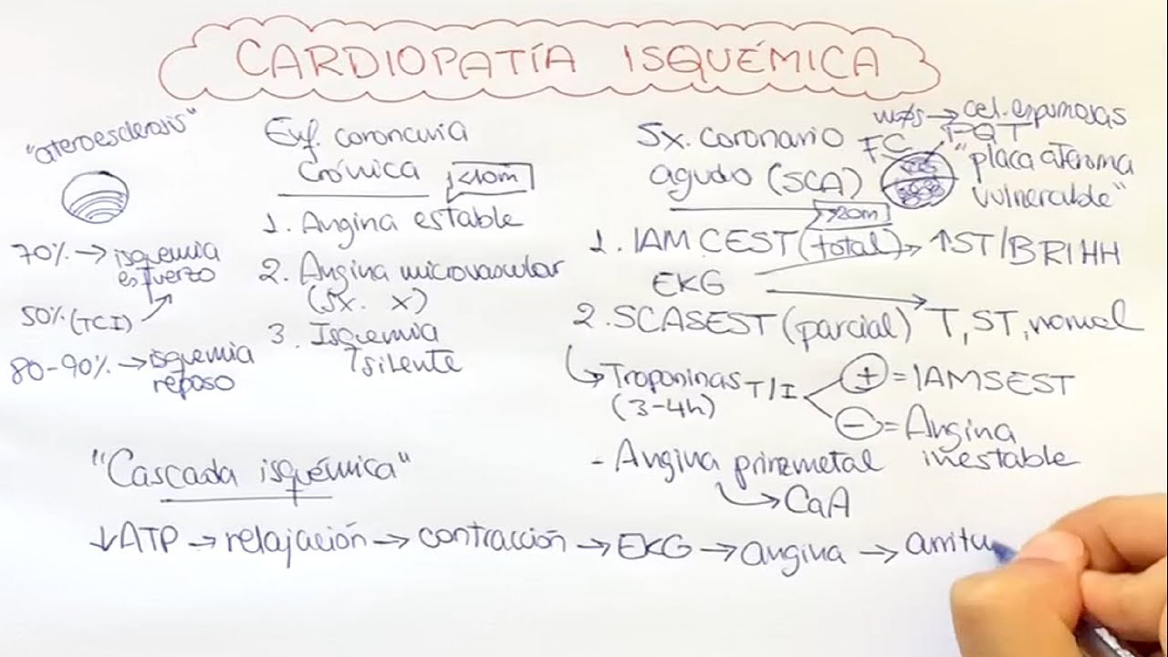 Cardiopatía isquémica (1): Angina estable, SCA: angina inestable, IMACEST, IMASEST, ...