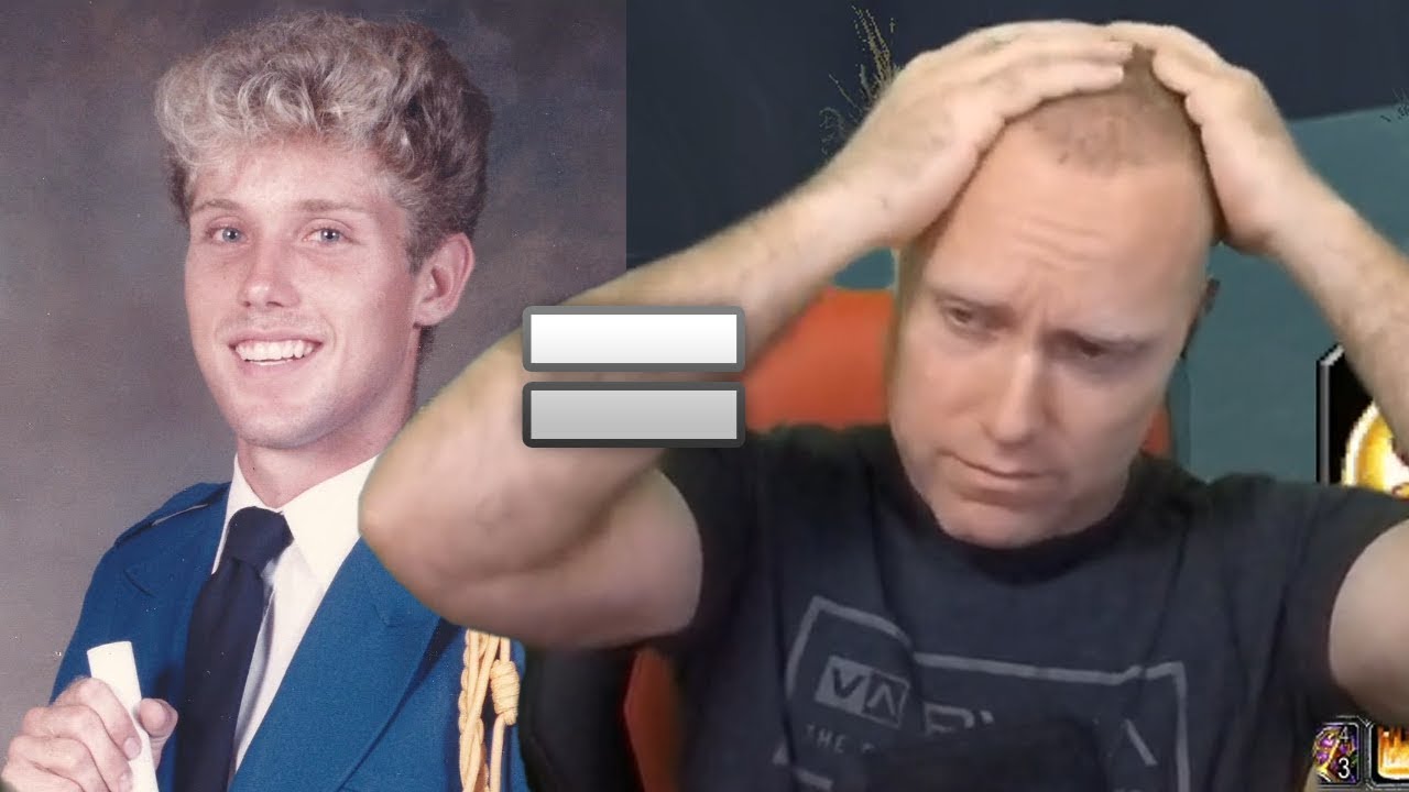 MY HAIR IS GONE? - Swifty & Chinglish Discuss Hair Loss and More (Stream Highlights)