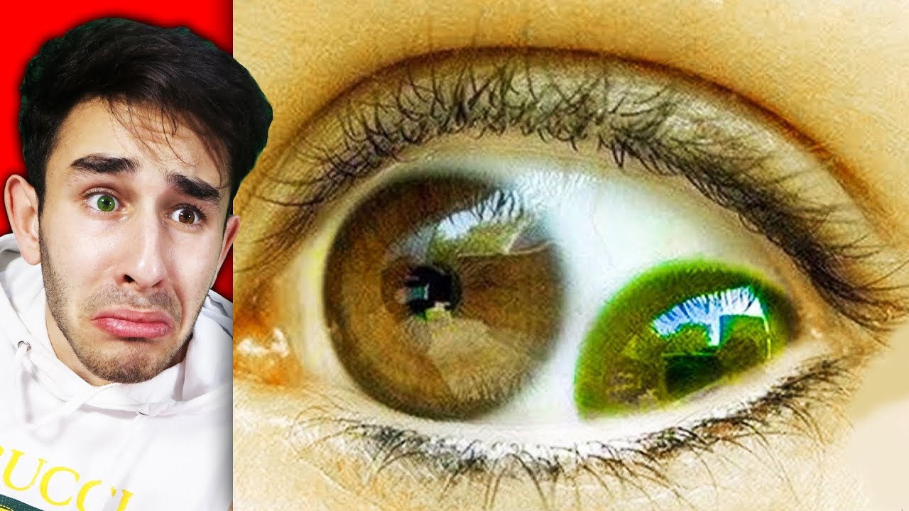 חלקי גוף הזויים שלא תאמינו שקיימים אצלכם בגוף!?!?