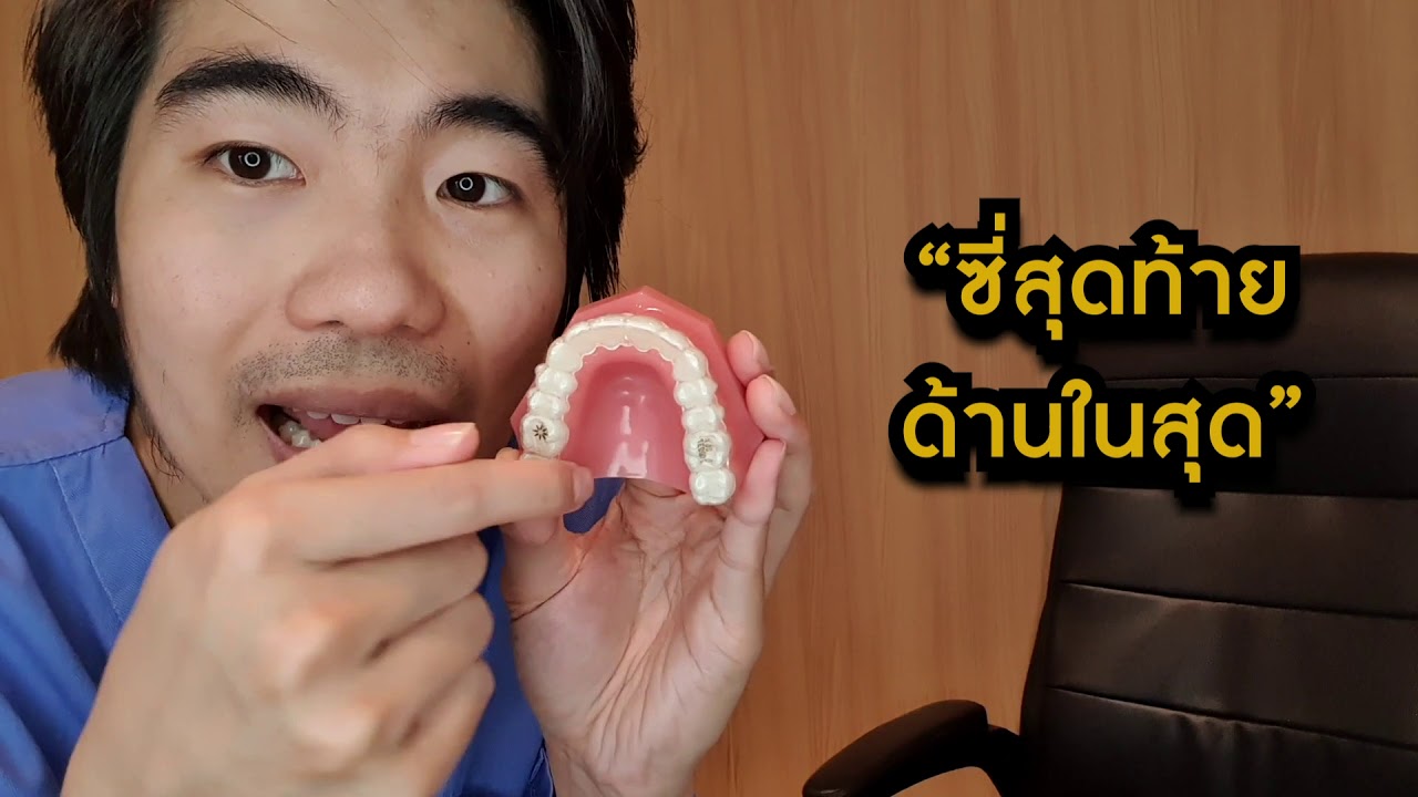 ปุ่มฟัน Invisalign วิธีใส่ ถอด Invisalign