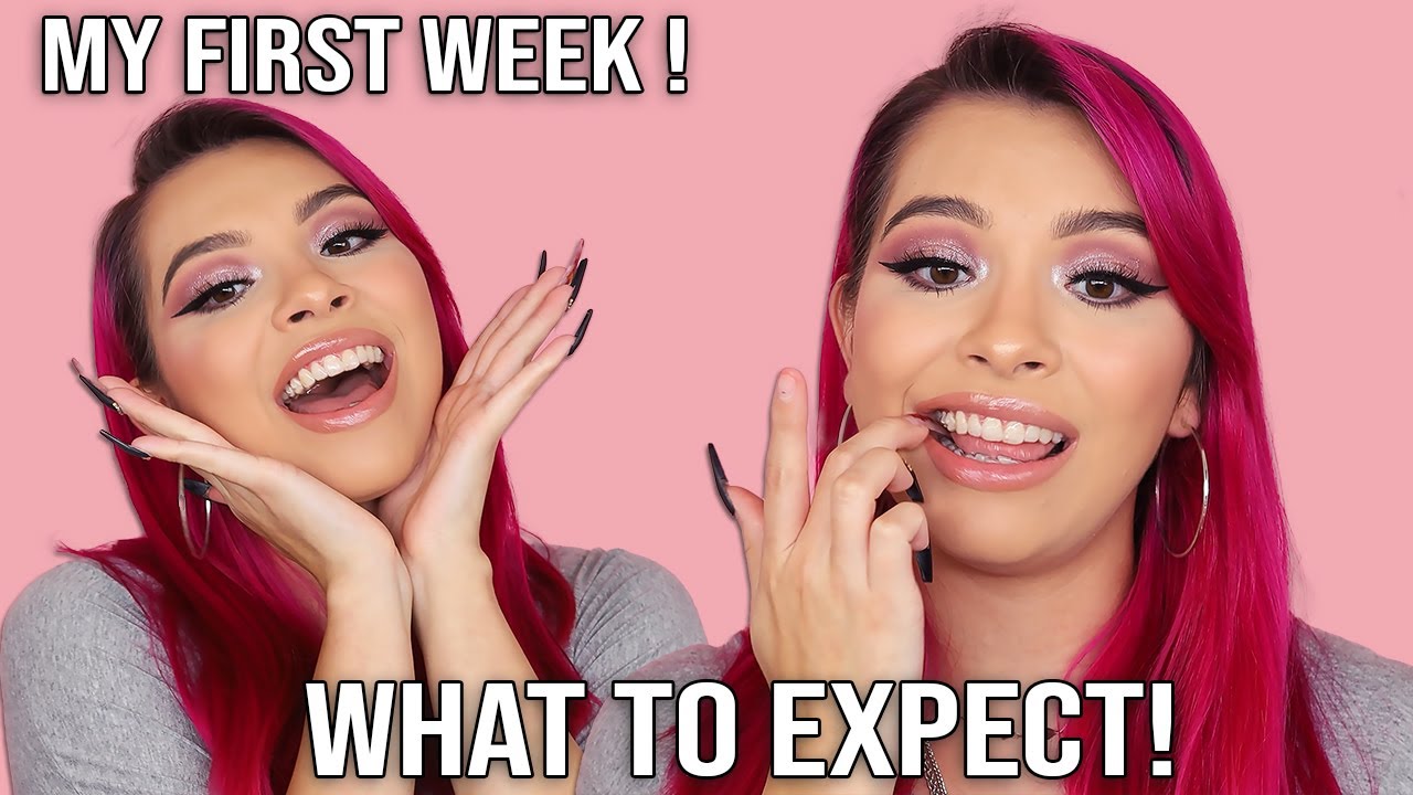 I STARTED MY INVISALIGN TREATMENT JOURNEY! GETTING MY INVISALIGN CLEAR ALIGNERS AND MY EXPERIENCE!