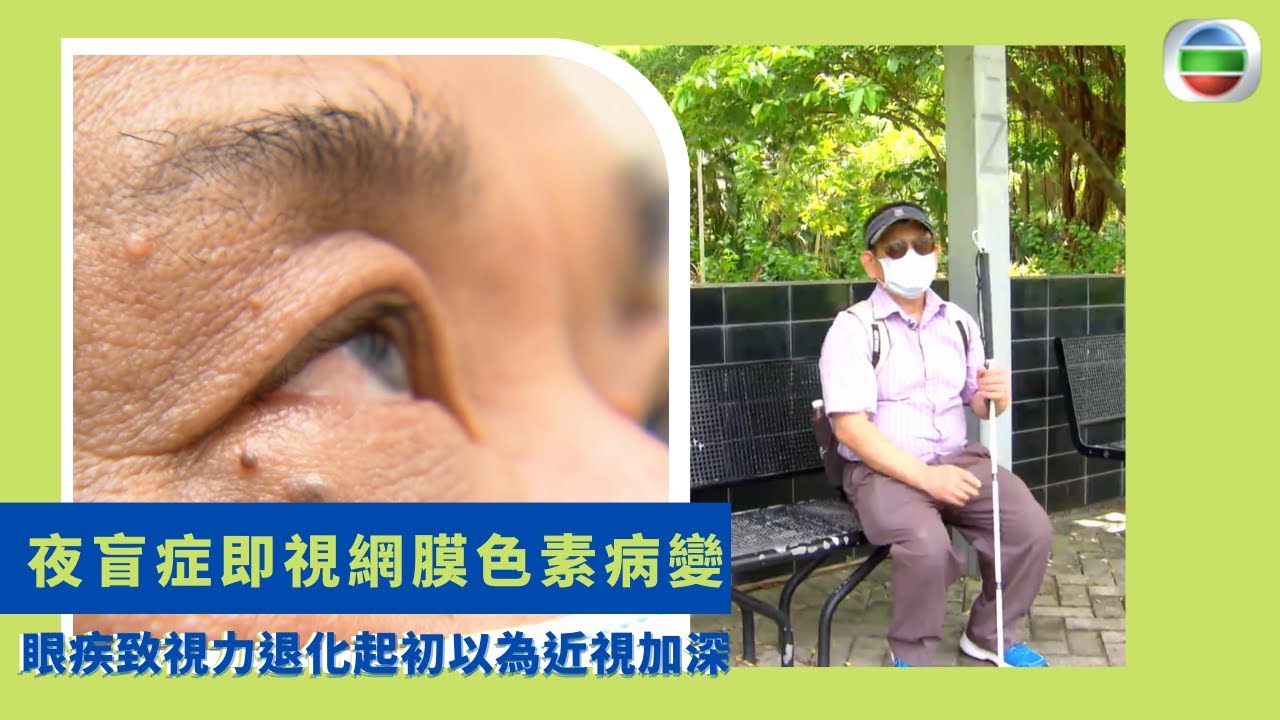 健康360 TVB｜夜盲症即視網膜色素病變 眼疾致視力退化起初以為近視加深 先天基因病變致視網膜退化 視桿細胞先受影響感光出問題 發病後視野縮窄出現管狀視野｜最強生命線