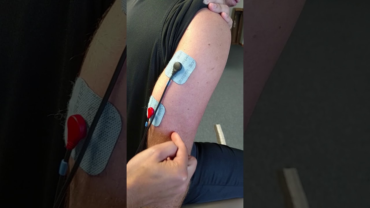 Compex tricep