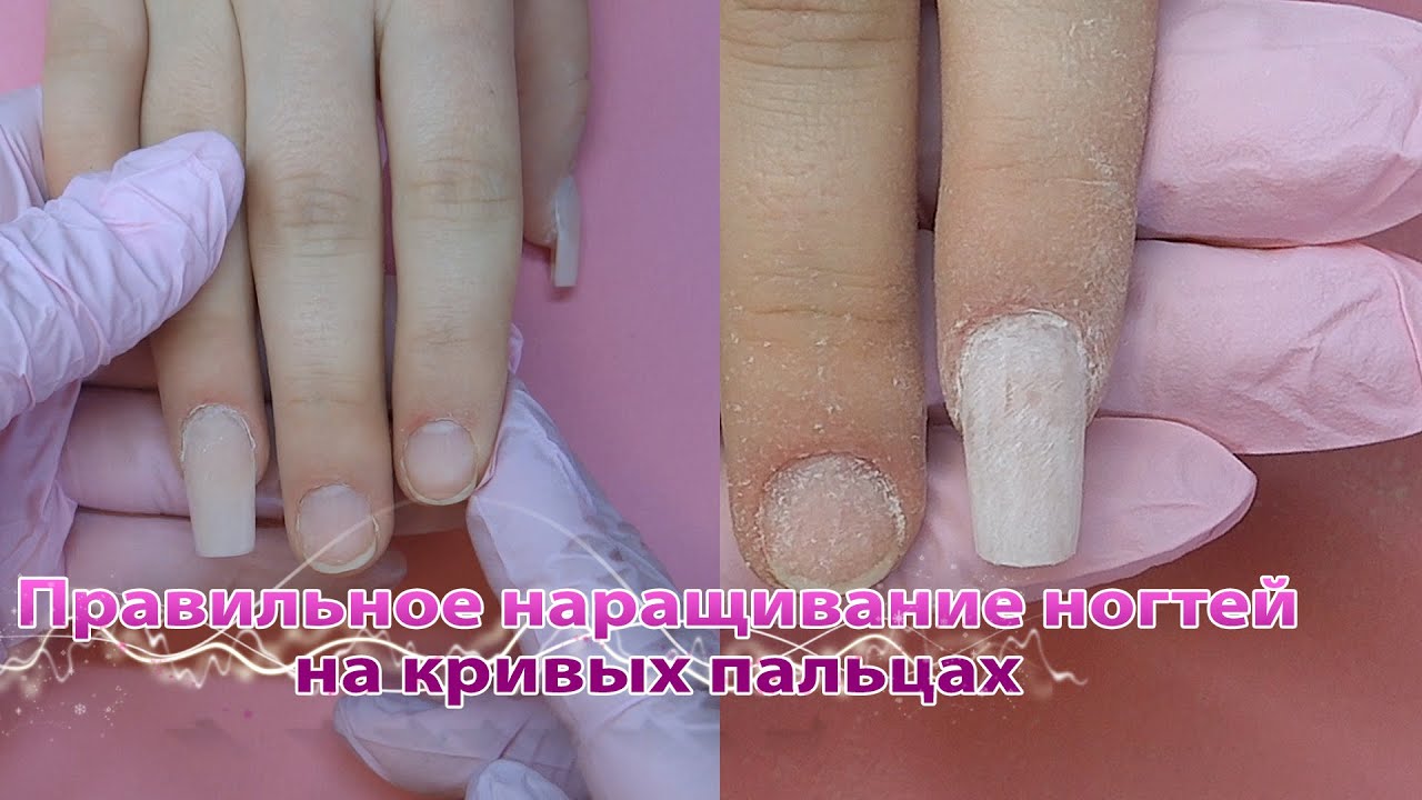 Наращивание ногтей на кривых пальцах