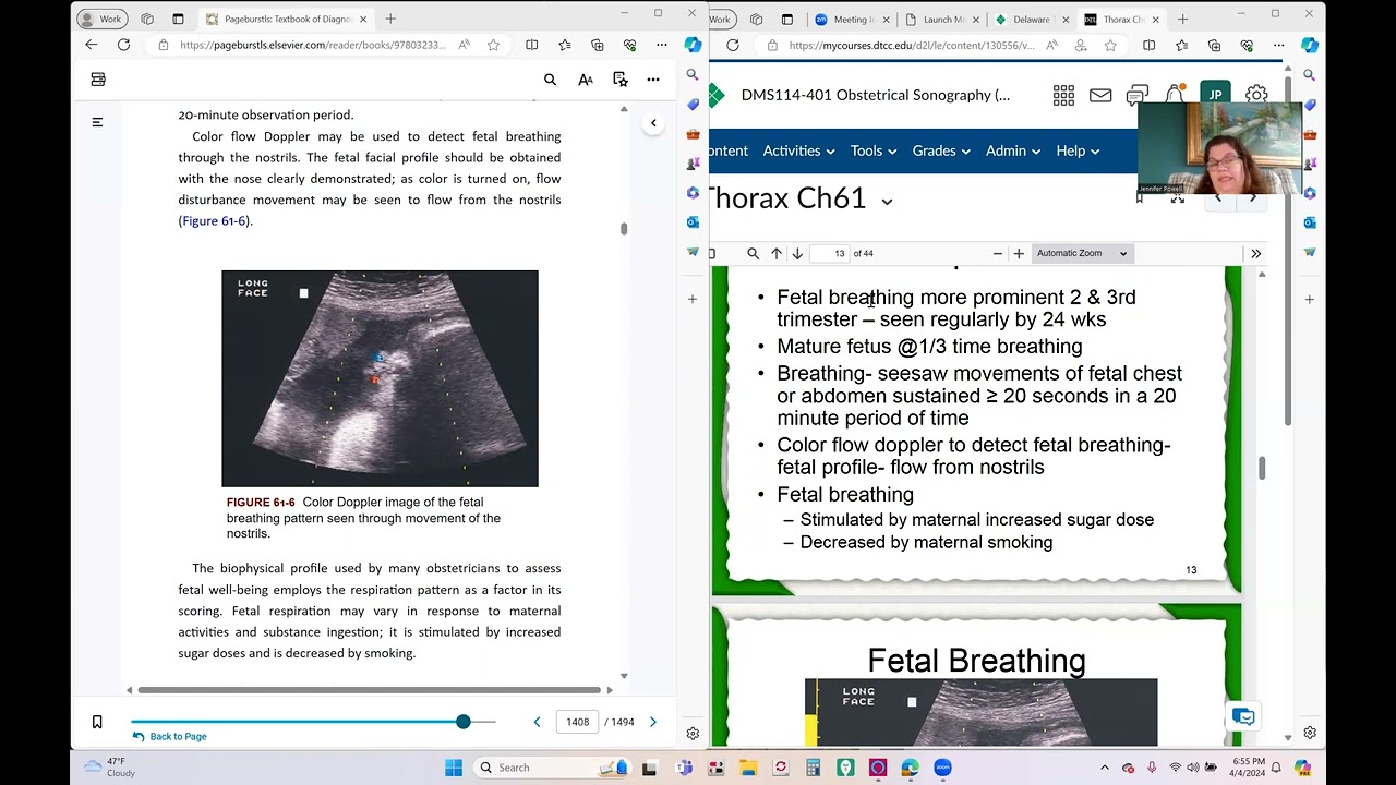 DMS 114 Ch 61 The Fetal Thorax