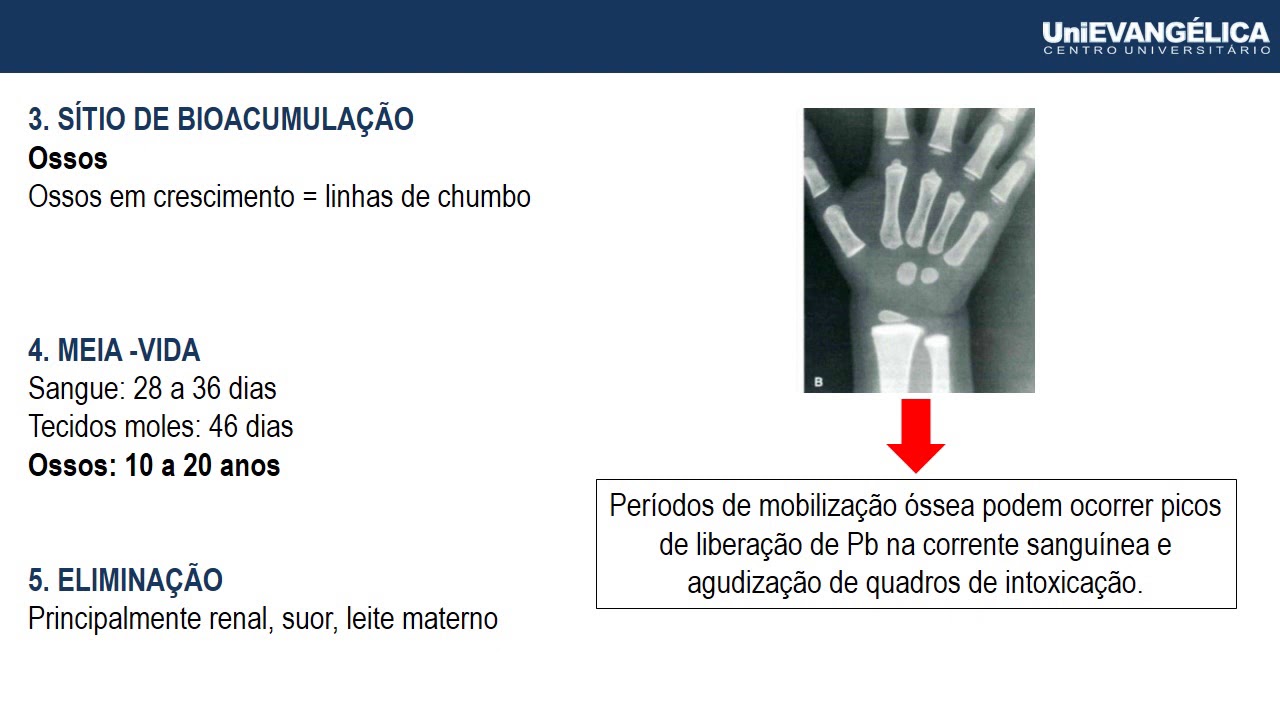 METAIS PESADOS   CHUMBO