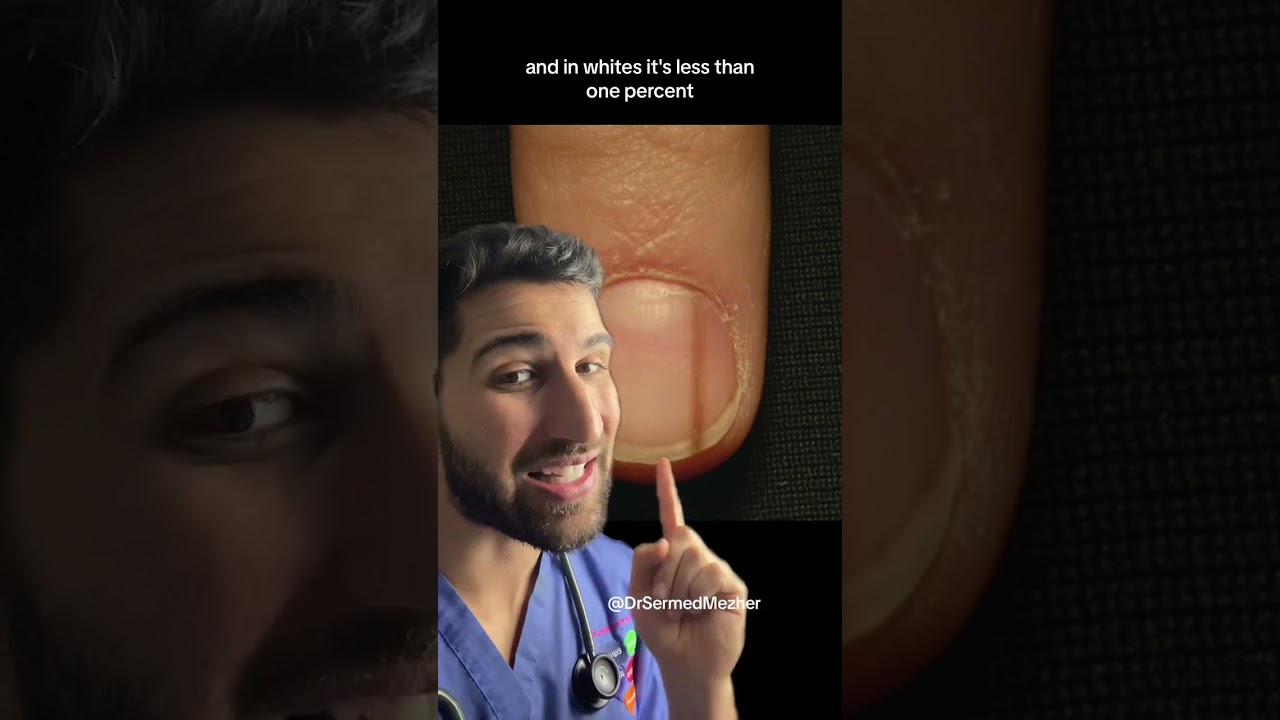 When You Have a Landing Strip on Your Nail #worrying