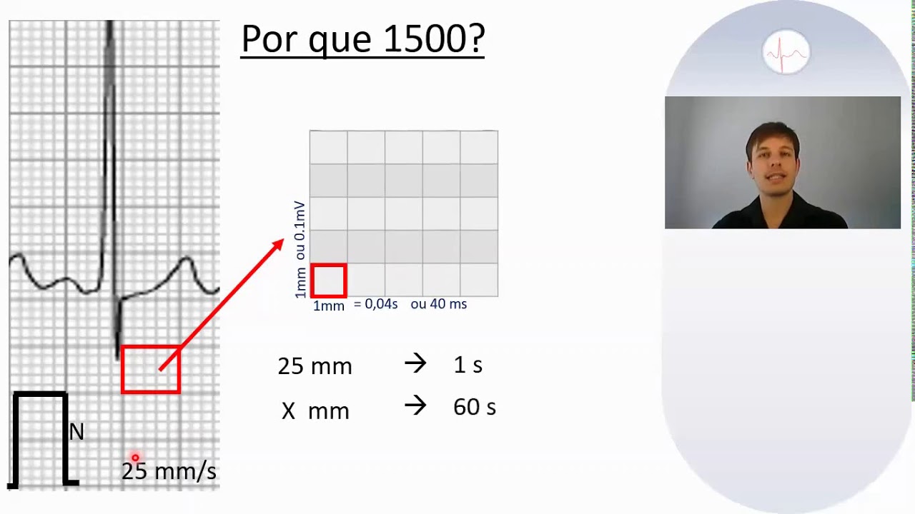 Como laudar um eletrocardiograma 3/4 (cálculo da frequência cardíaca)