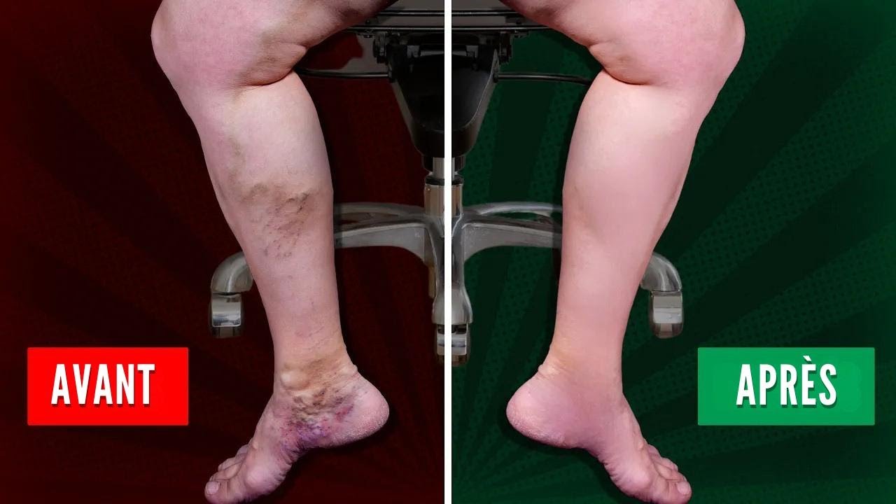 5 exercices simples pour booster la circulation des jambes au bureau