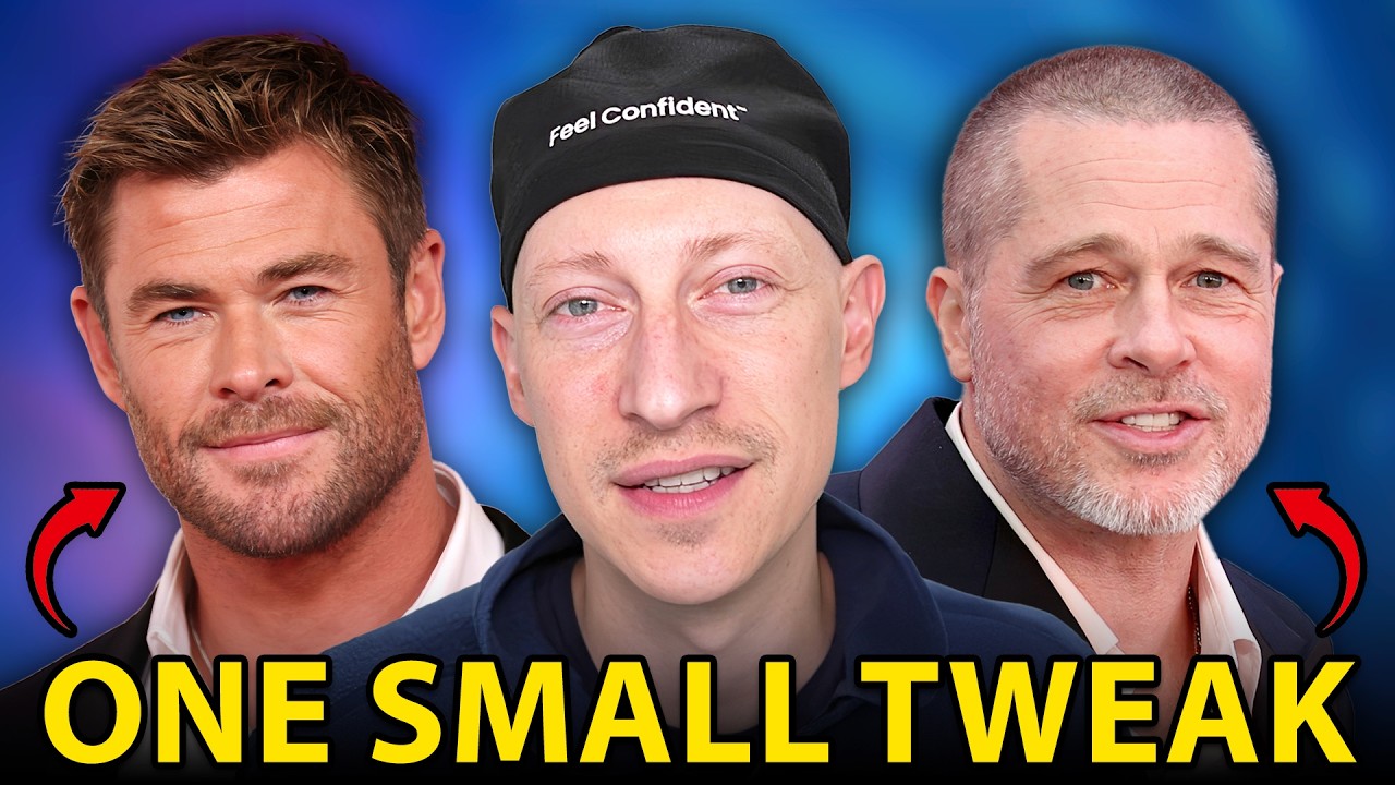 Want To Get Your Temples Back? (Temple Hair Transplants)