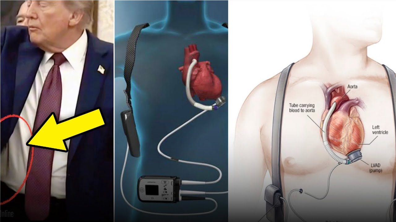 КРИЗИС ЗДОРОВЬЯ Трампа ХУЖЕ, чем мы думали&hellip;