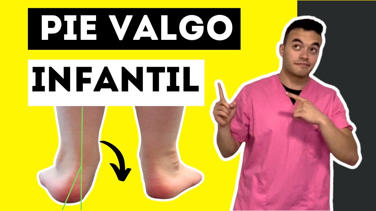 🦶 PIE VALGO en NIÑOS  ✅ ¿Es preocupante? ❌ Lejancitos el podólogo responde