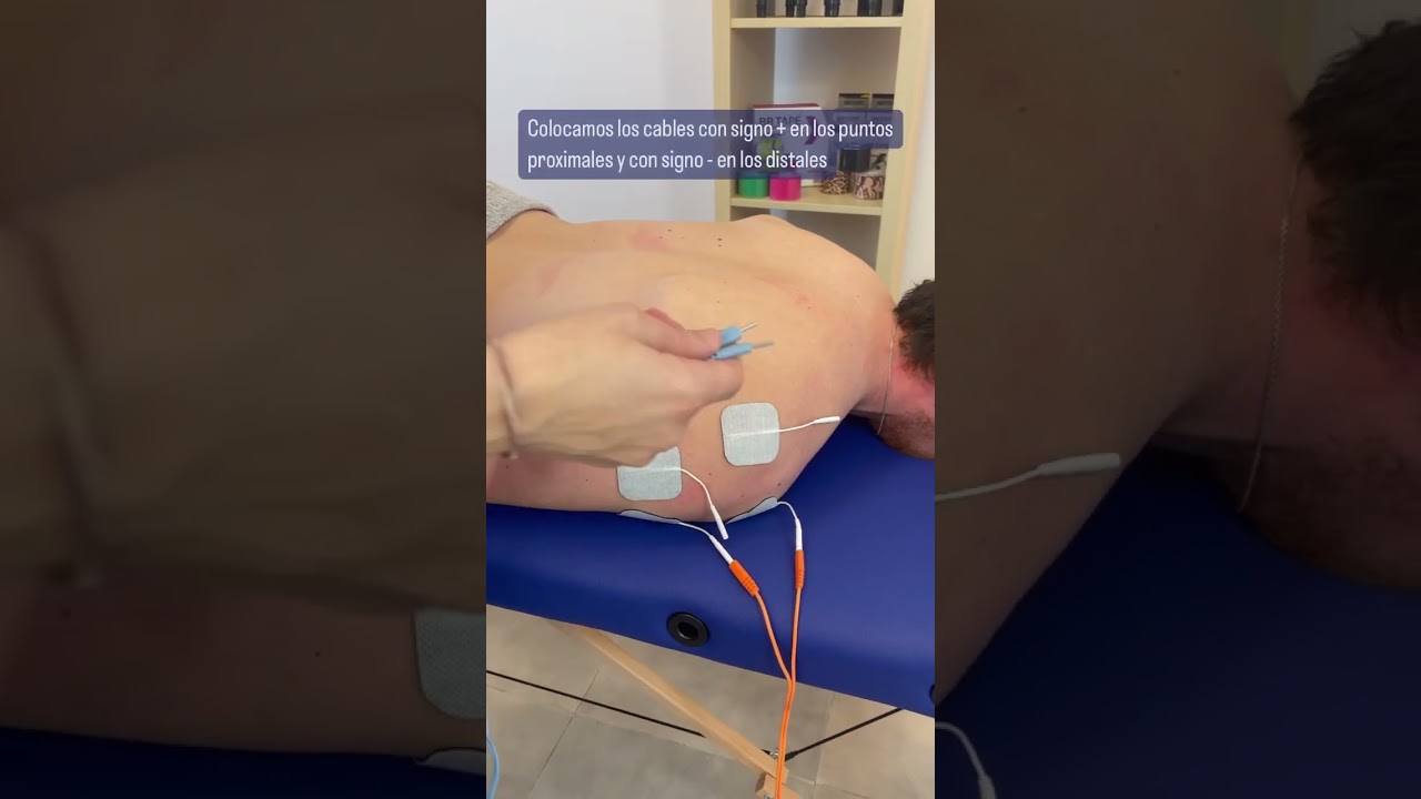 Como bajar un dolor de hombro con electroestimulaci&oacute;n! 💥 #fisioterapia #tens #fisioterapeuta