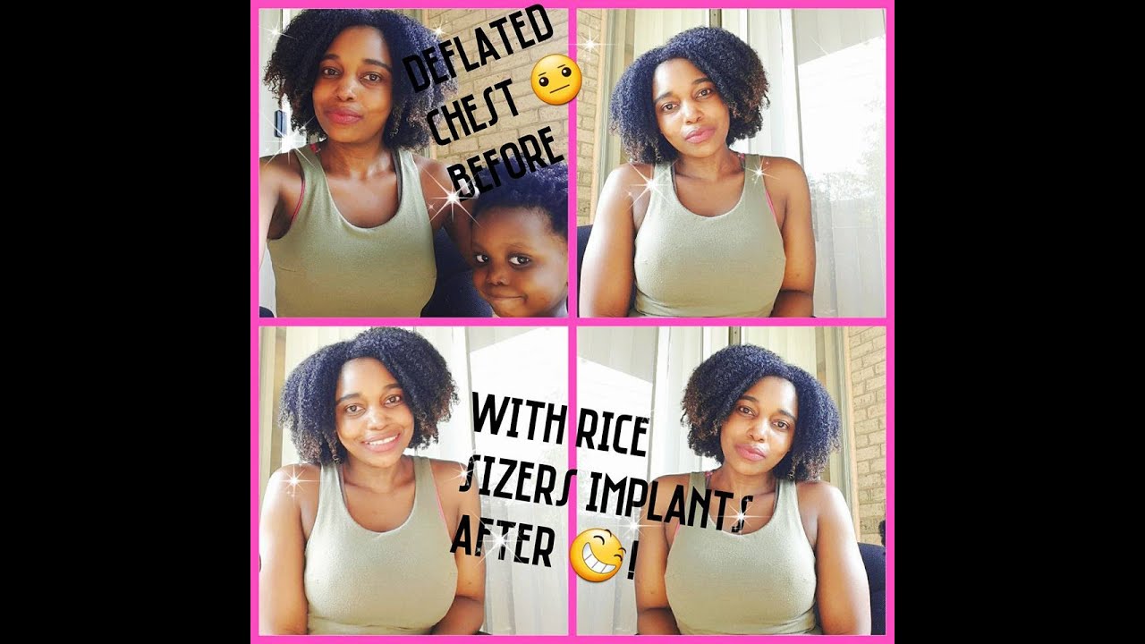 ♡ 420ccs Rice Implants + How to deal with mommy boobs insecurities!♡