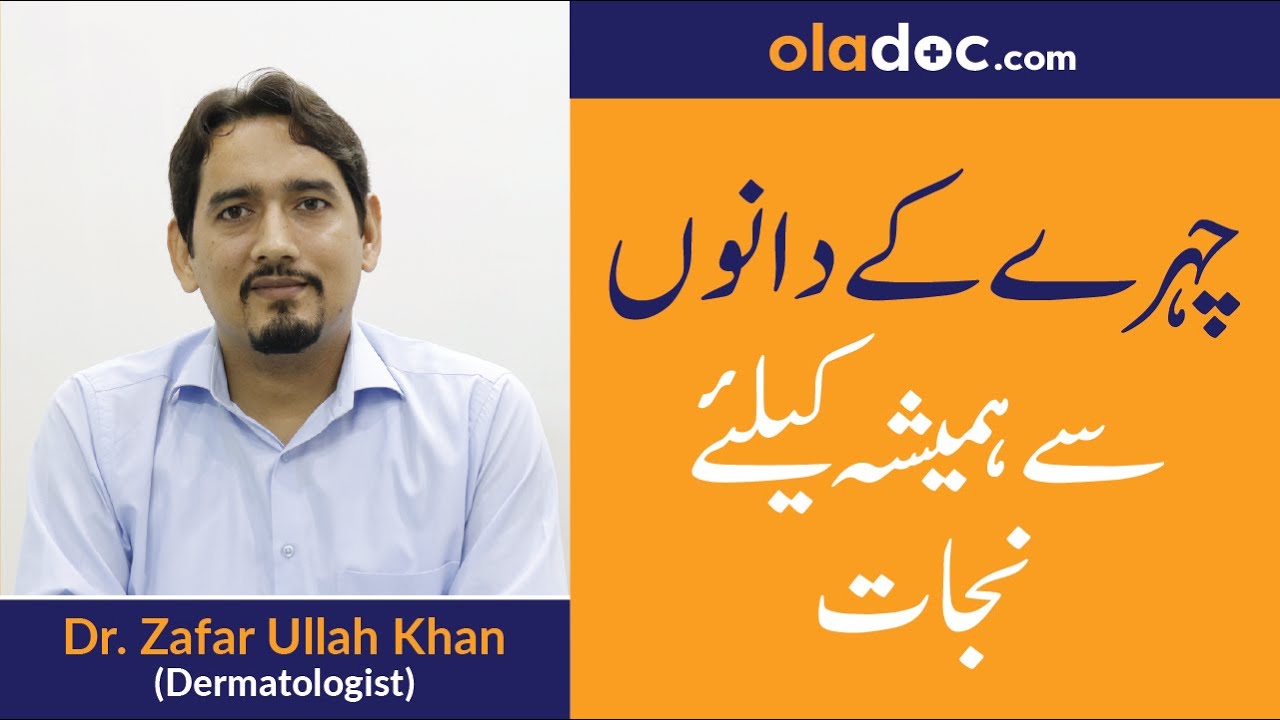 How to Treat Acne Scars Ka Elaj/Ilaj Dano Ke Nishan Kaise Khatam Karen|Acne Spots