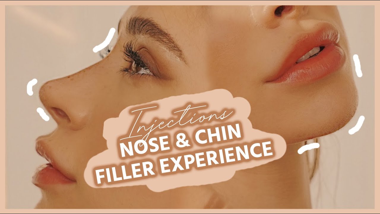 MY FILLER EXPERIENCE | non surgical nose job nose filler & chin filler BareBeautyNurses biibiibeauty