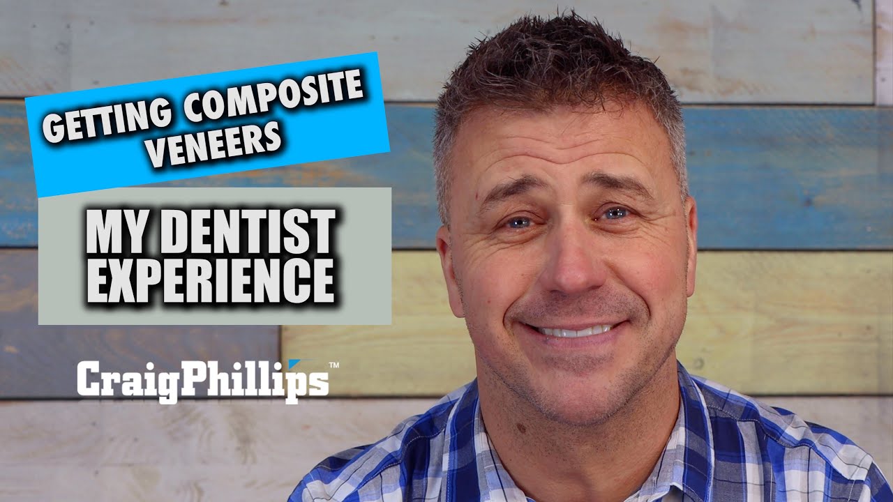 Getting Composite Veneers - My Experience