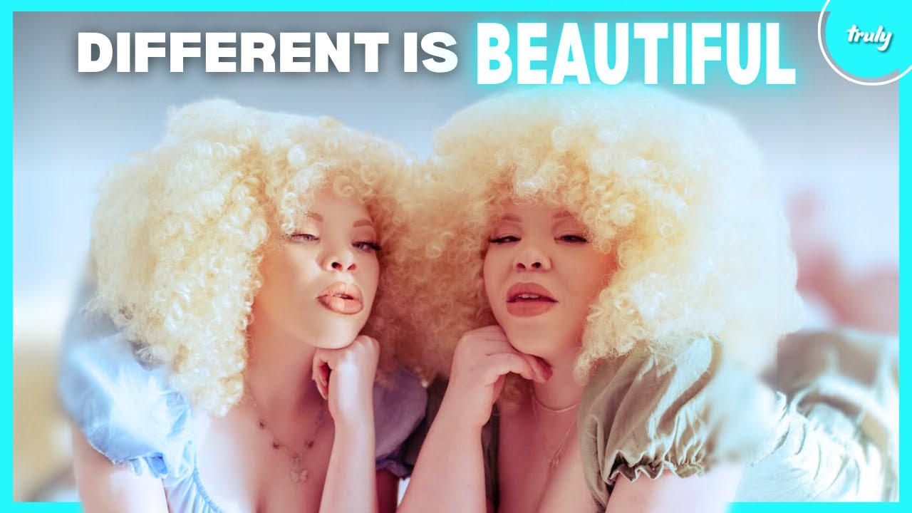 Born To Stand Out: Albinism | BORN DIFFERENT