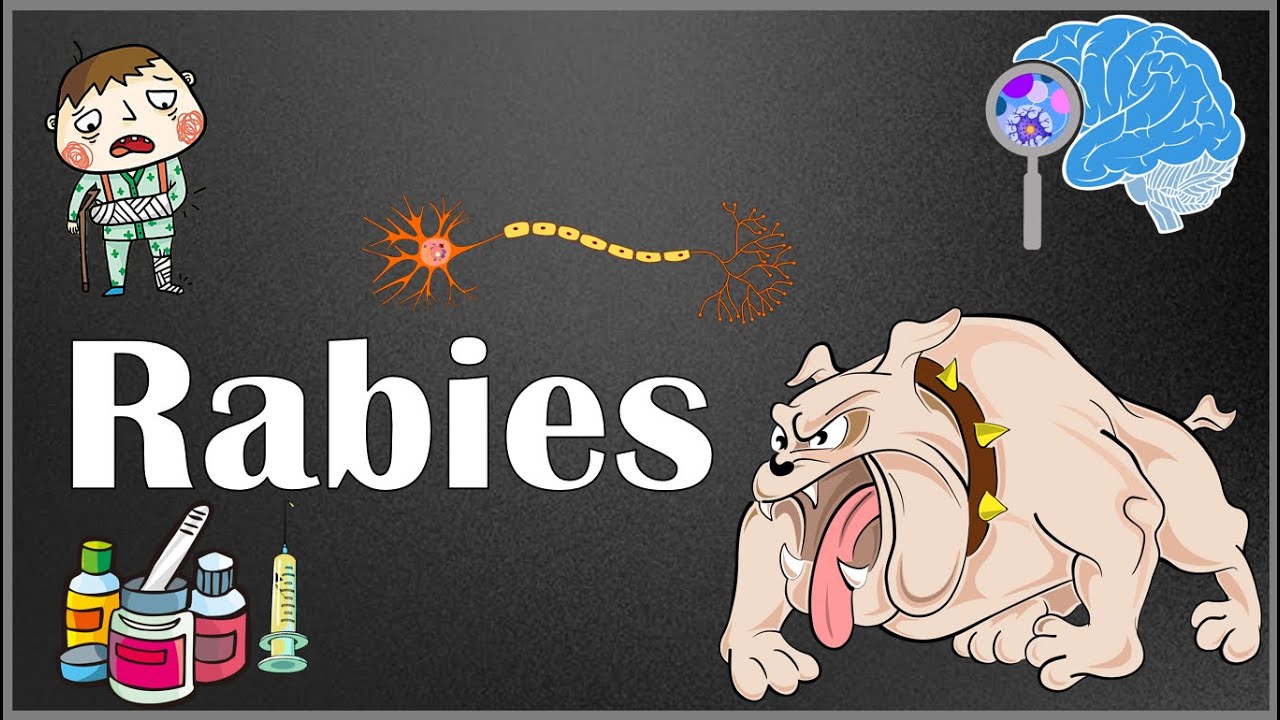 Rabies : Pathophysiology, Signs & Symptoms, Diagnosis & Management (Pre & post exposure prophylaxis)