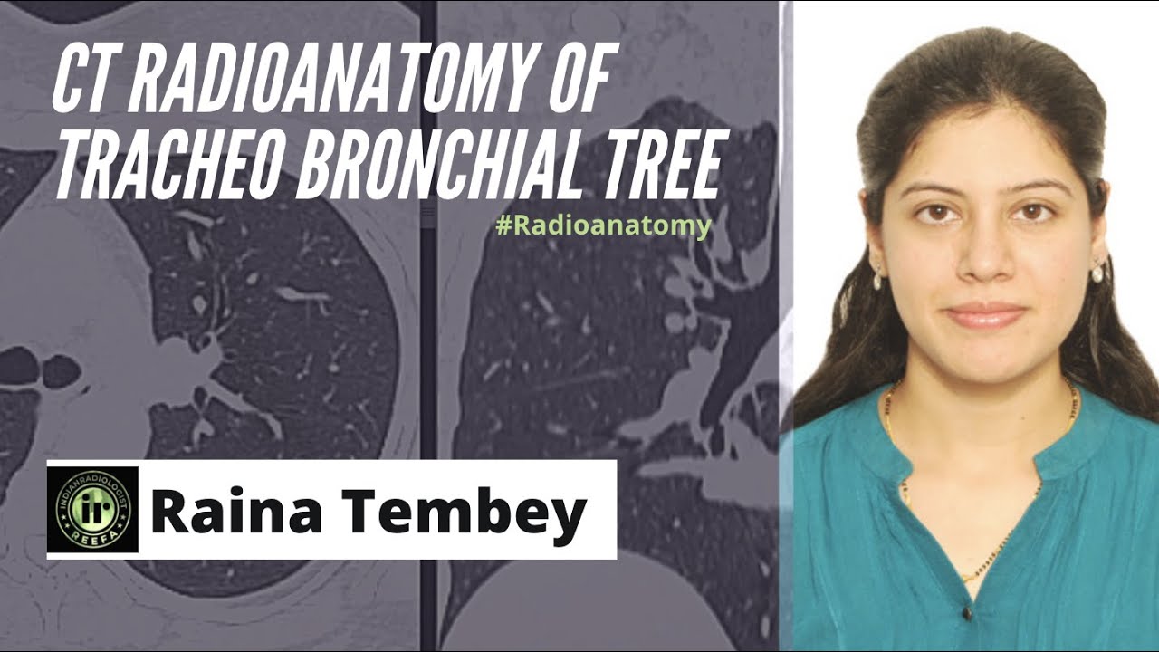 CT TRACHEOBRONCHIAL TREE ANATOMY | RAINA TEMBEY | HRCT CHEST | RADIOANATOMY TRACHEA AND BRONCHI