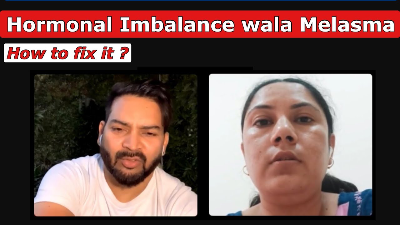 How to fix Hormonal Imbalance wala Melasma ?
