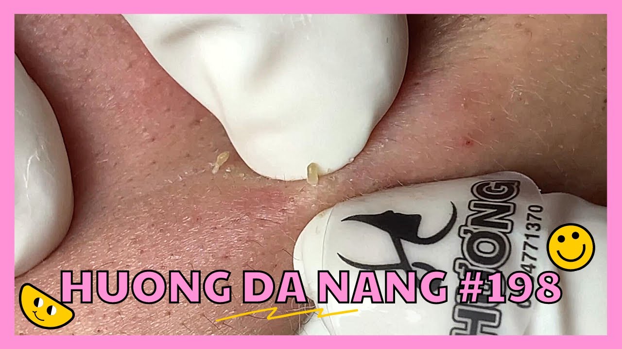 #198 | Huong Da Nang