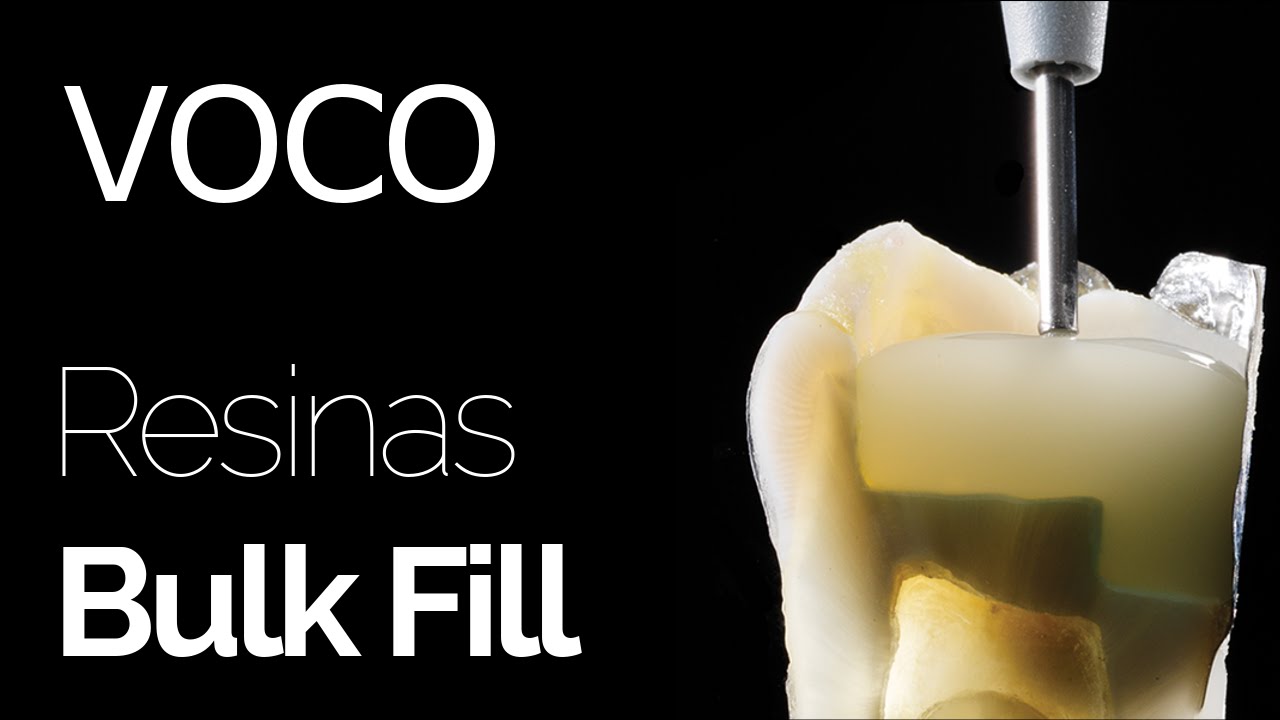 Voco - Resinas Bulk Fill