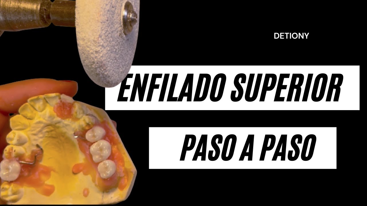COMO enfilar Dientes en Protesis Parcial