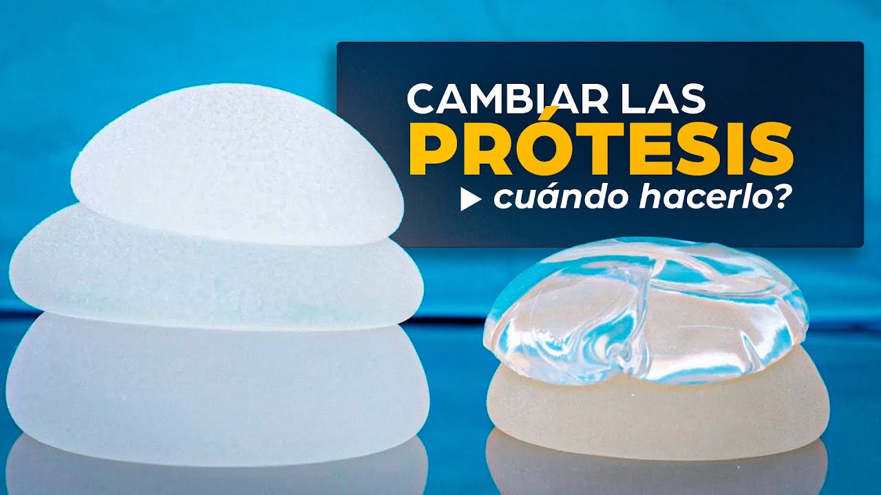 ¿Cada cuánto hay que cambiar las prótesis mamarias?  Dr. Martín Fernández
