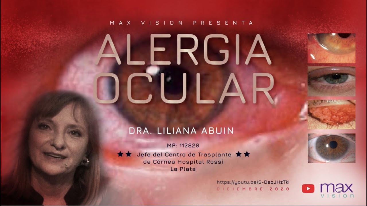 Alergia Ocular - Dra. Liliana Abuin