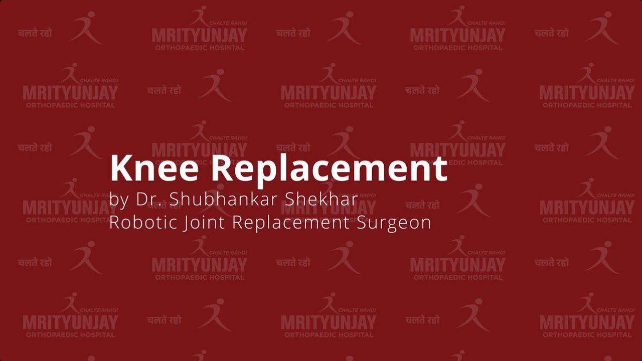 Knee Replacement Surgery: Myths, Facts & Modern Advancements