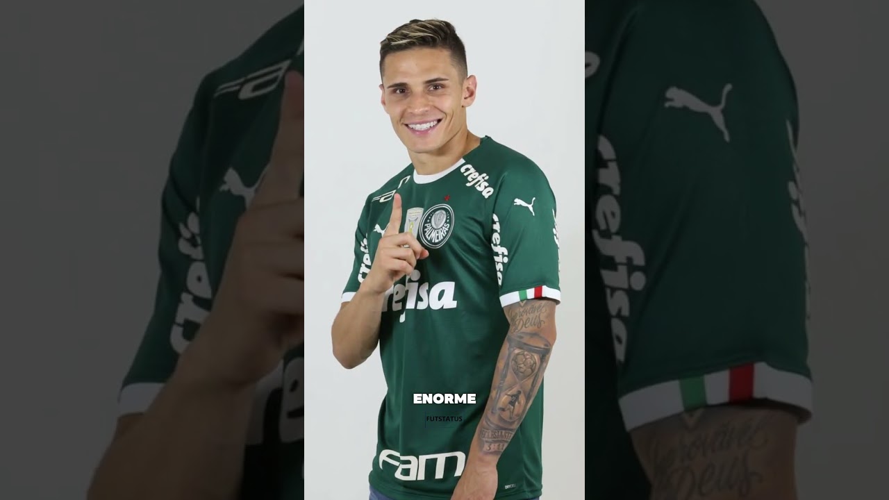 POR QUE O RAPHAEL VEIGA USA MANGUITO?