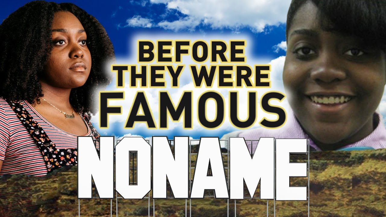 NONAME - Before They Were Famous - TELEPHONE