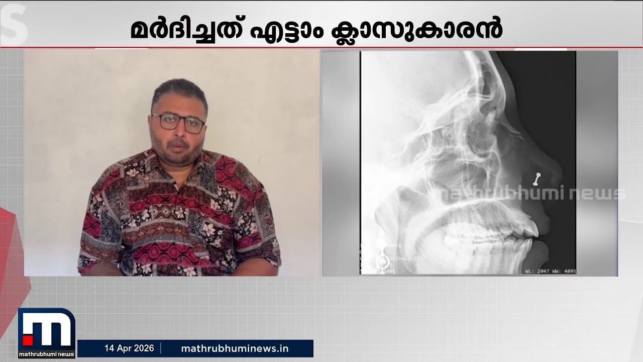 ​ഗെയിം കളിക്കുന്നത് തടഞ്ഞു, എട്ടാം ക്ലാസുകാരൻ അധ്യാപികയെ മർദിച്ചു; മുഖത്ത് ​ഗുരുതര പരിക്ക്
