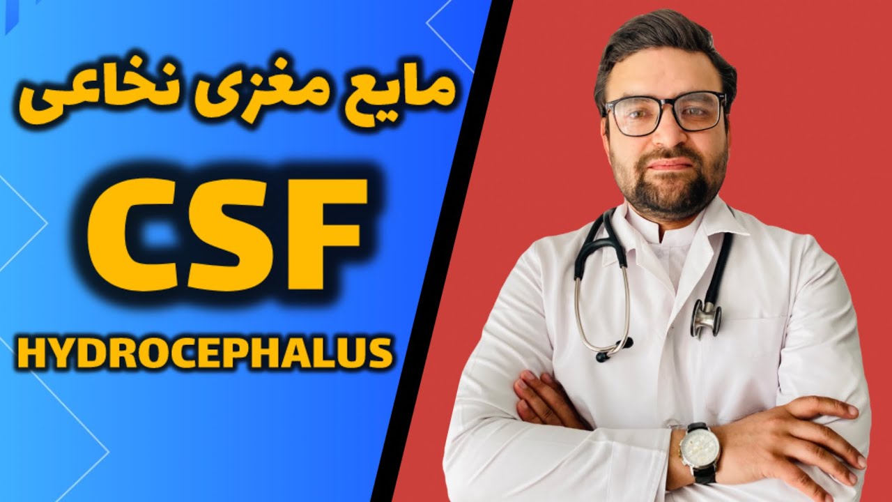 Doctor Waheed | جمع شدن آب در سر نوزادان و اطفال ؟