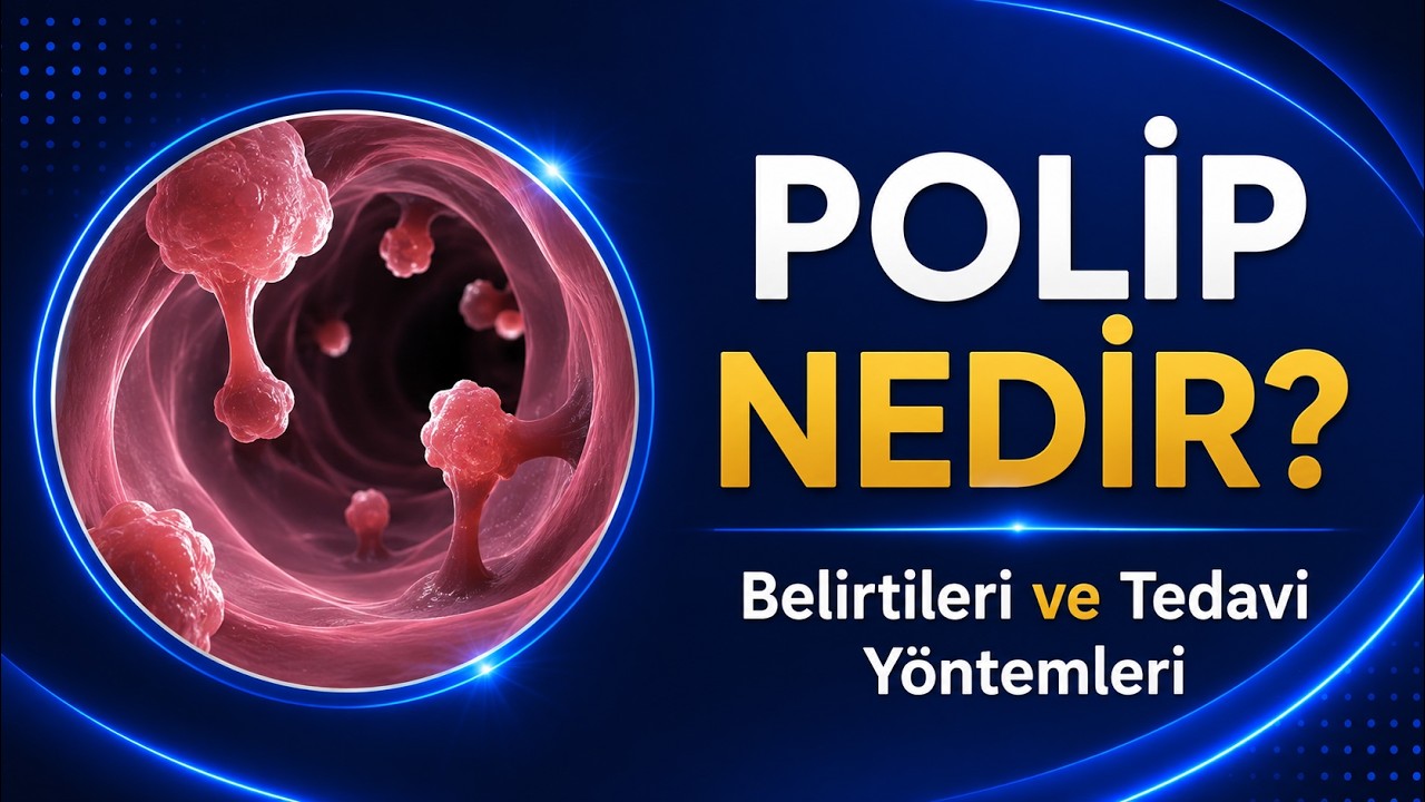 POLİP NEDİR?