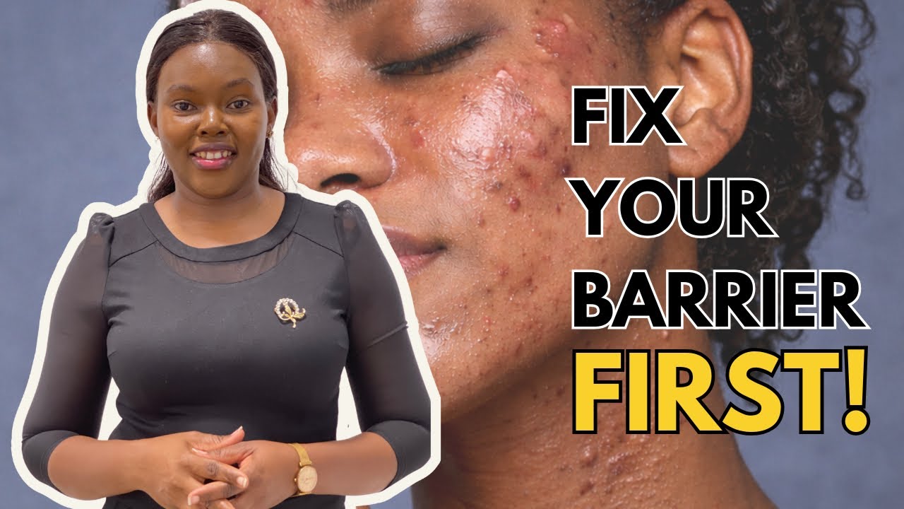 Repair Your Damaged Skin Barrier Before Treating Acne or Dark Spots 