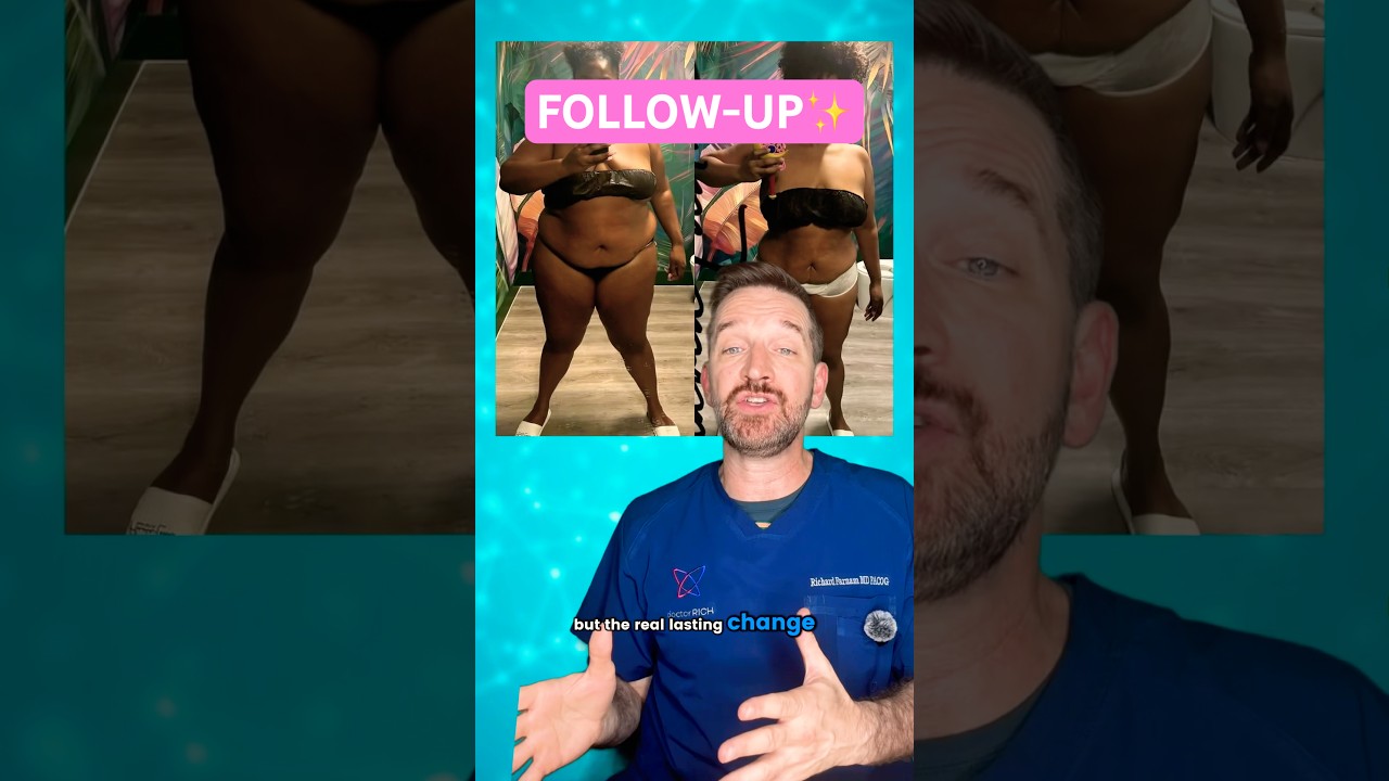 Following up on GLP-1 and @Lizzo &ldquo;weight release ￼journey&rdquo; #weightloss #glp1 #ozempic ￼