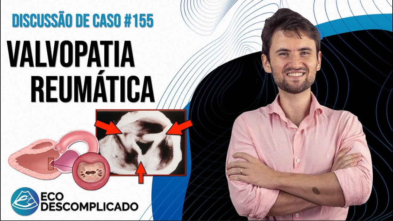 Como identificar uma Valvopatia Reumática no ECO | EcoDescomplicado Discussão de Casos #155