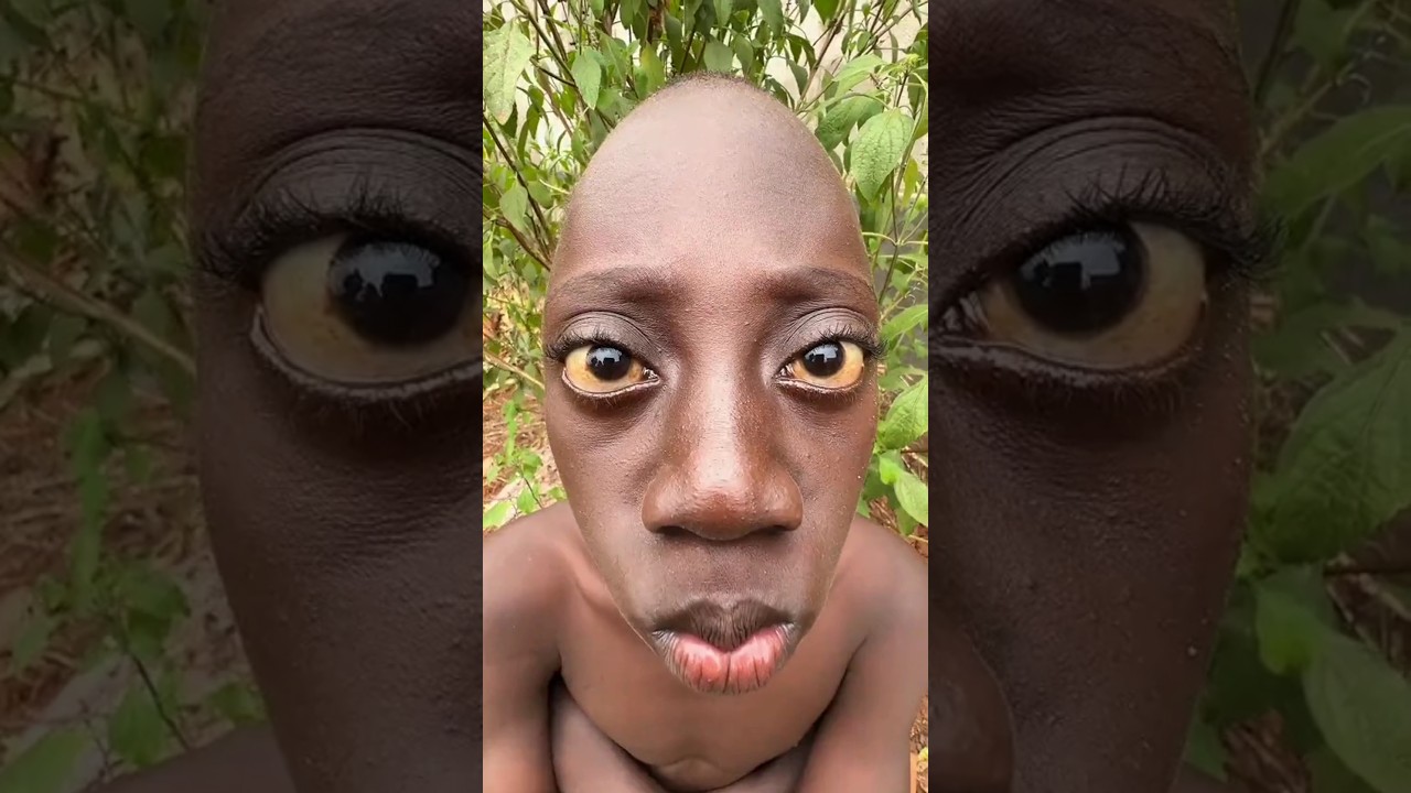 Tenge Tenge has Frightened me#wntv #tengetenge #youtubeshorts #funny