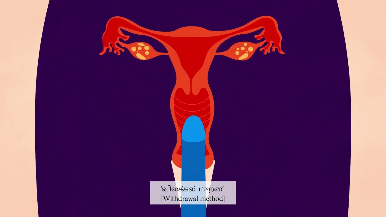 Contraception in Tamil