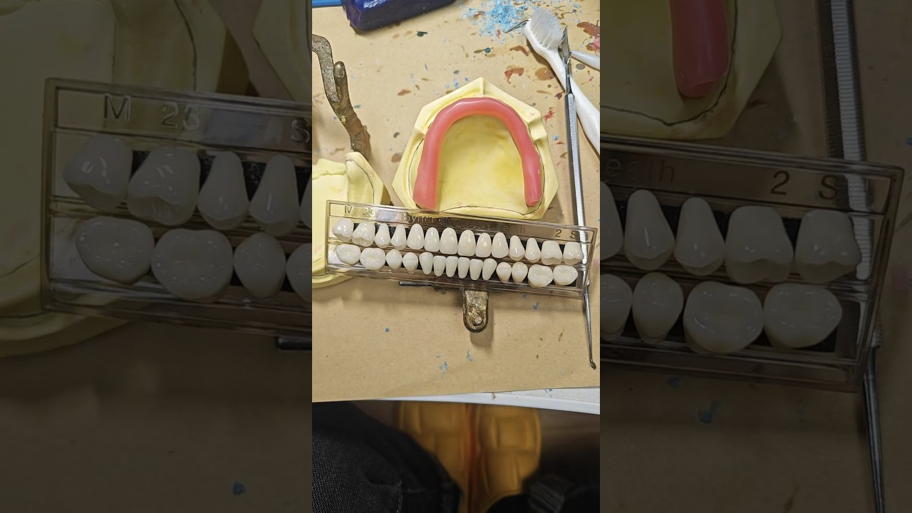 cecalai直播 full‑mouth tooth setup