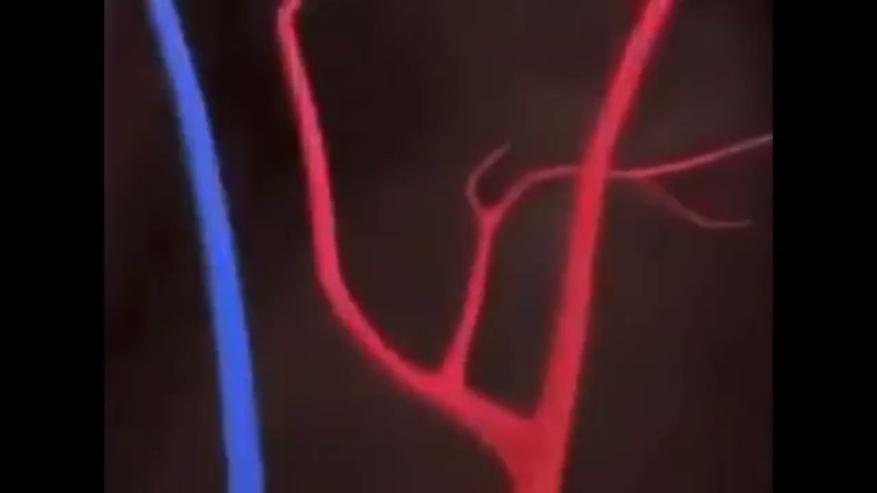 brain fart meme slowed high pitch