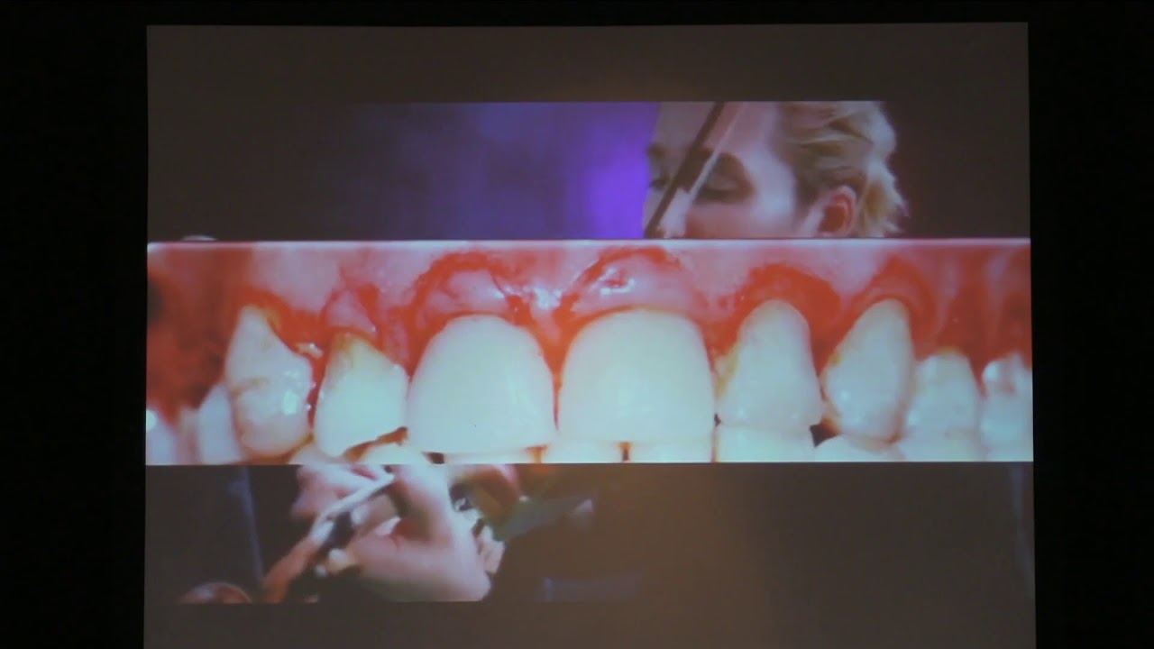 XIV Congreso Odontol&oacute;gico Interdisciplinario - Periodoncia