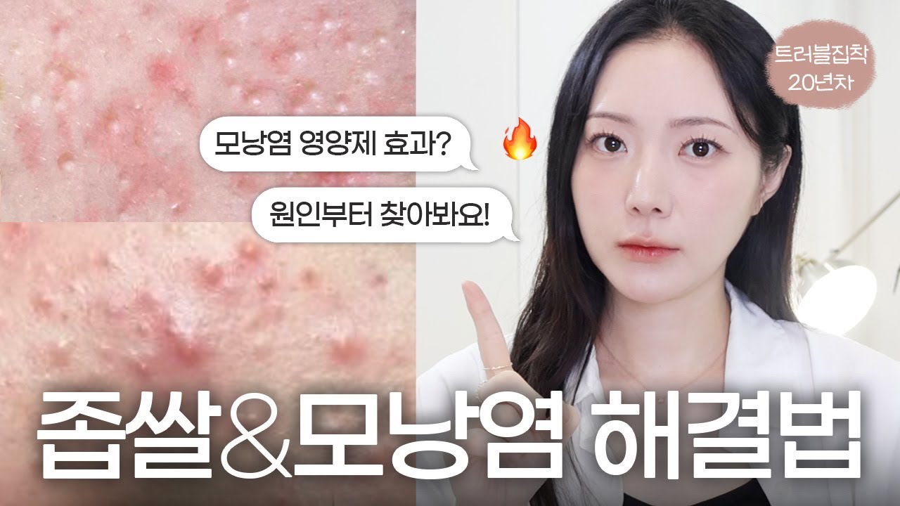 좁쌀여드름, 모낭염 싹없애보자‼️좁쌀 순삭 팩, 모낭염 영양제 싹 다 추천 리뷰 | 좁쌀 모낭염 차이점, 원인부터 해결법까지