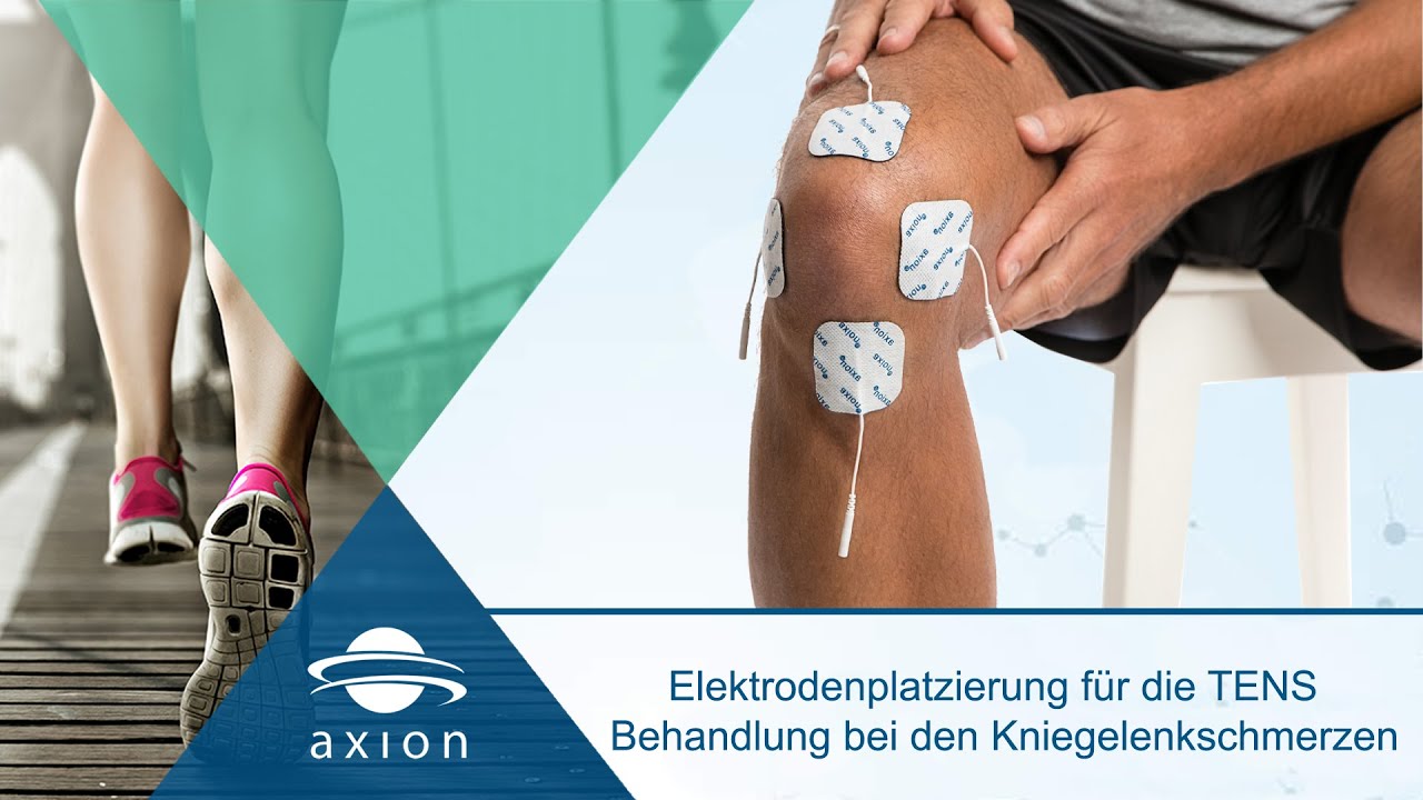Kniegelenkschmerzen - Elektrodenplatzierung f&uuml;r TENS | axion