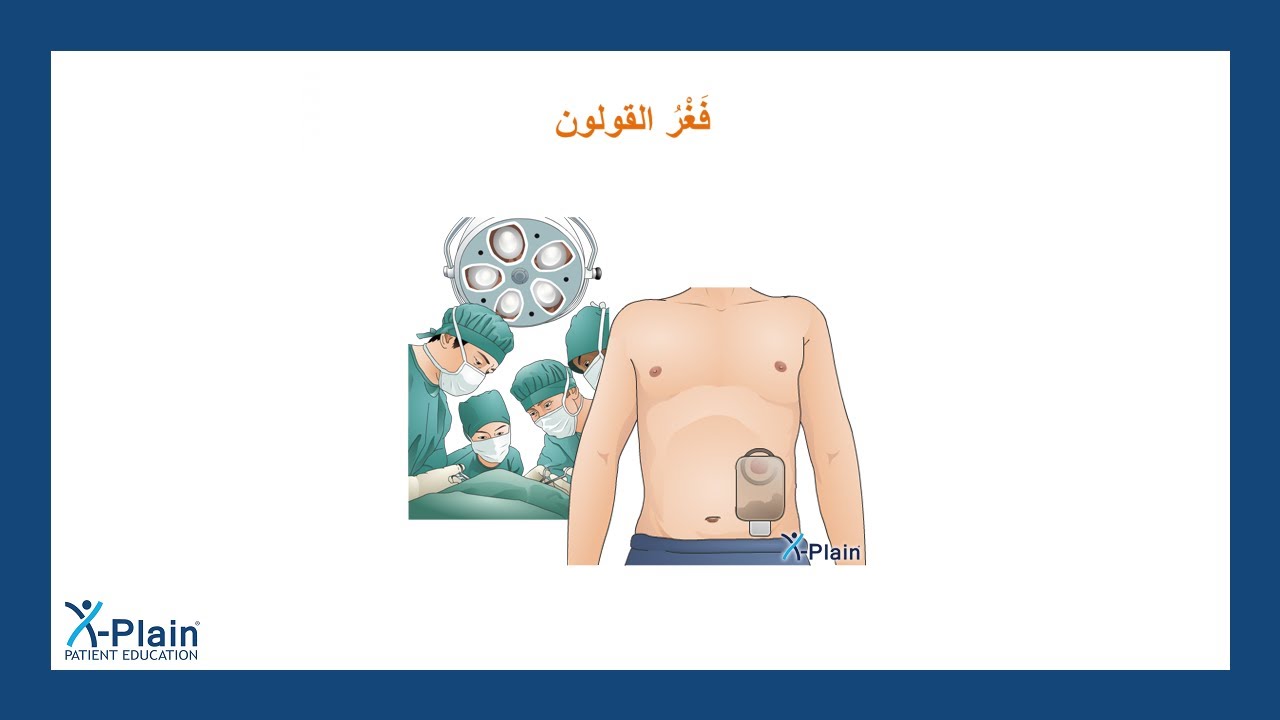 فغر القولون