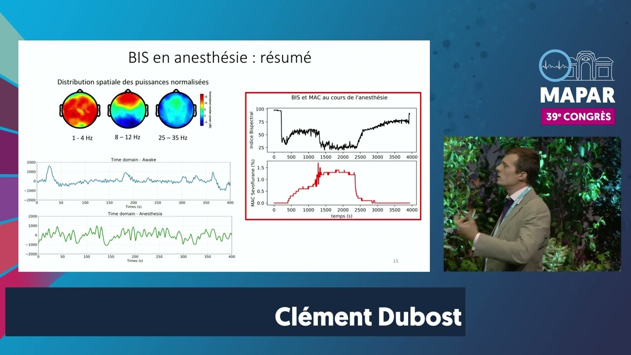 Monitorage de la profondeur d’anesthésie en salle d’opération - Dr Clément Dubost